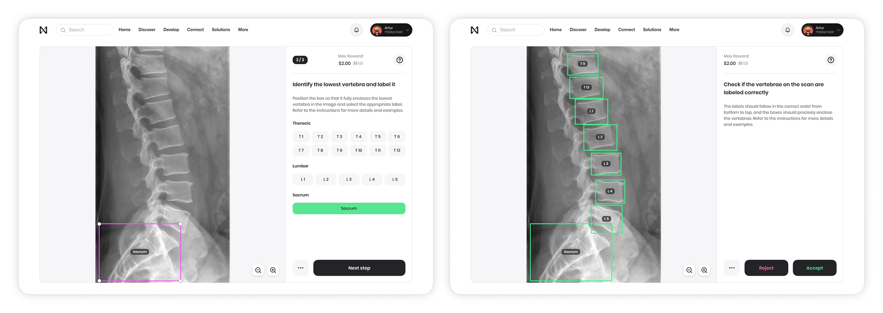 NEAR Tasks: labeling an X-ray and peer verification